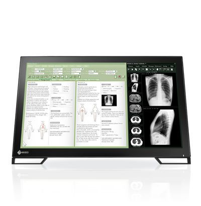 LCD display / medical / touch screen 23", 2 MP | RadiForce MS235WT EIZO Corporation