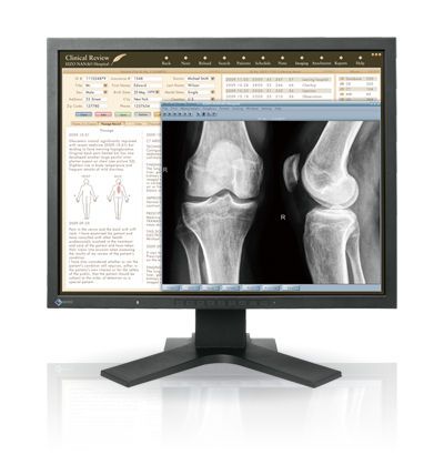 LCD display / medical 21.3", 2 MP | RadiForce MX210 EIZO Corporation