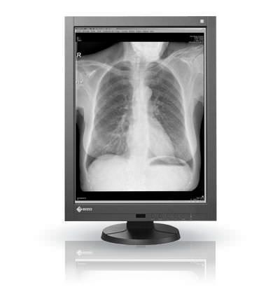 LCD display / monochrome / high-definition / medical 21.3", 3 MP | RadiForce GX340 EIZO Corporation