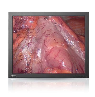 LCD display / surgical 19" | RadiForce SCD 19102 EIZO Corporation