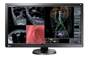 High-definition display / LCD / medical 31.1", 8 MP | RadiForce RX850 EIZO Corporation