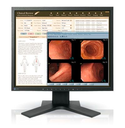 LCD display / medical 19", 1 MP | RadiForce MX191 EIZO Corporation