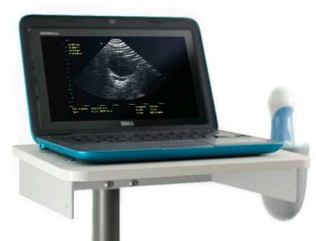 Portable ultrasound bladder scanner QUICKSCAN™ The Prometheus Group Portable ultrasound bladder scanner QUICKSCAN™ The Prometheus Group