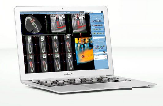 Viewing software / for dental imaging Planmeca Romexis® Viewer Planmeca