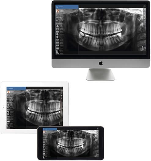 Dental imaging iOS application / viewing mRomexis™ Planmeca