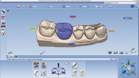 CAD software / CAM / for dental prosthesis design / medical Planmeca PlanCAD® Planmeca