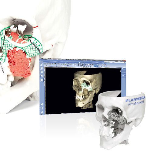 Dental prosthesis design software / CAM / CAD / medical Planmeca ProModel Planmeca