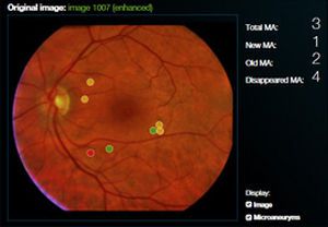 Viewing software / diagnostic / medical / ophthalmology RetmarkerDR critical-health