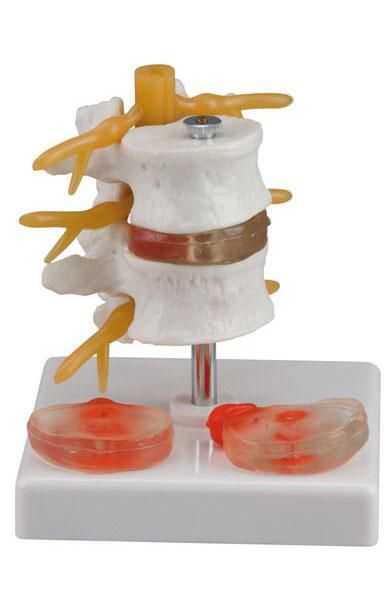 Lumbar vertebra anatomical model 6042.35 Altay Scientific