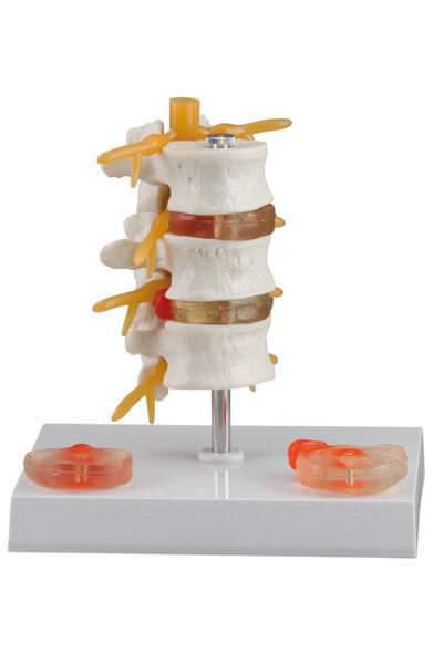 Lumbar vertebra anatomical model 6042.34 Altay Scientific
