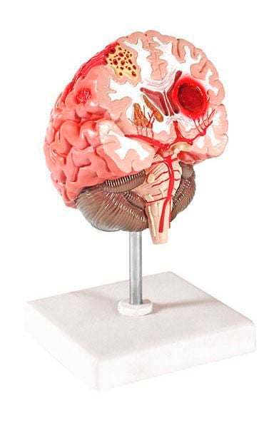Brain anatomical model 6160.24 Altay Scientific