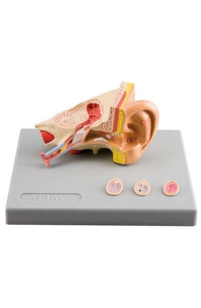 Ear canal pathology anatomical model 6220.10 Altay Scientific