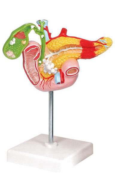 Pancreas pathology anatomical model 6090.23 Altay Scientific