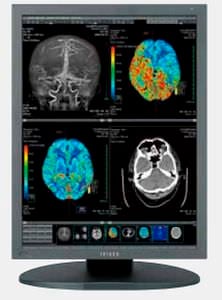 LCD display / medical 21.3", 2 MP | CCL256i2 TOTOKU