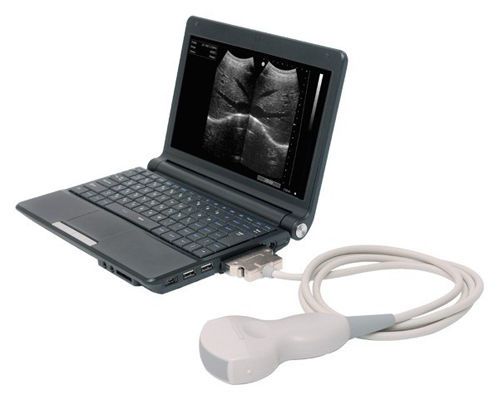 Portable ultrasound system / for gynecological and obstetric ultrasound imaging / all-in-one probe KJ-605 Xuzhou Kejian Hi-tech