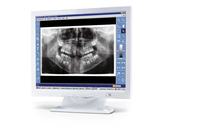 sirona sidexis download