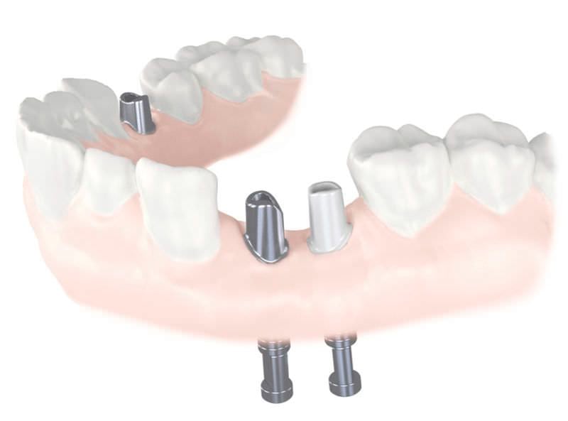 CAD software / for dental prosthesis design / medical CyrtinaCAD40 Cyrtina Dental Group