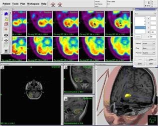 Planning software / management / for radiosurgery / medical Leksell GammaPlan® series Elekta