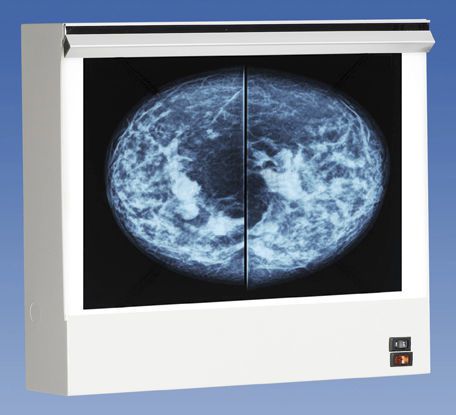 White light X-ray film viewer / 1-section / for mammography VuPlus Wolf X-Ray Corporation