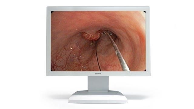 High-definition display / surgical 42" HD TRUMPF Medizin Systeme
