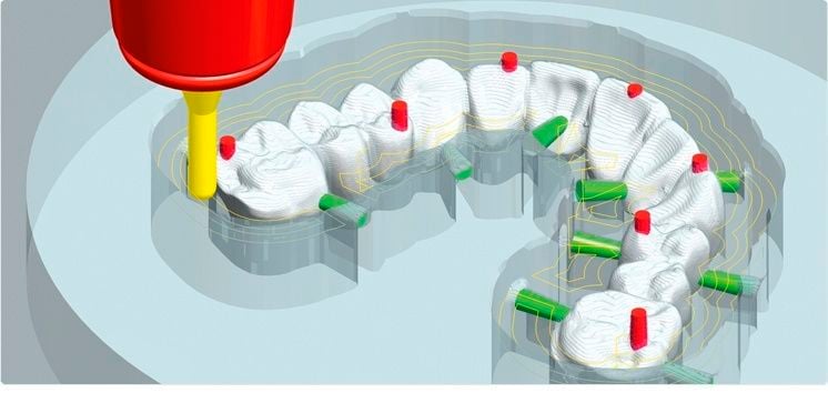 Prosthesis fabrication software / CAM / medical / dental Zfx