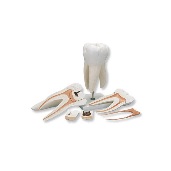 Tooth anatomical model YA/D051 YUAN TECHNOLOGY LIMITED