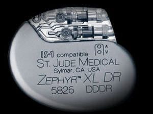 Implantable cardiac stimulator Zephyr™ St. Jude Medical
