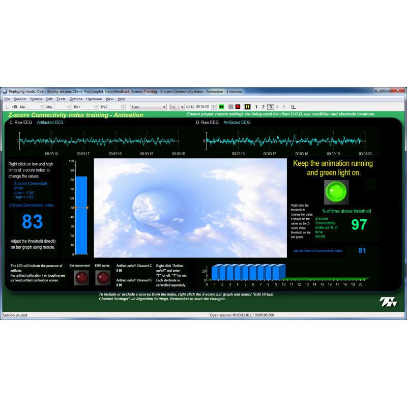Training software / monitoring / EEG / electrophysiology Suite Z-Score 6 - SA7965 Thought Technology
