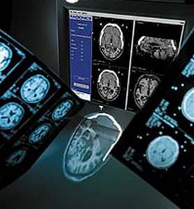 Multimodal image fusion software / medical imaging Integra™ ImageFusion™ INTEGRA
