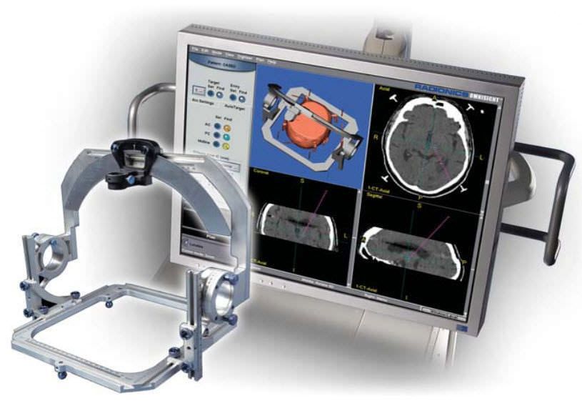 Preoperative planning software / medical / for stereotactic neurosurgery NeuroSight® Arc INTEGRA