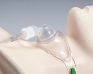 Tracheostomy mask / facial GaleMed Corporation