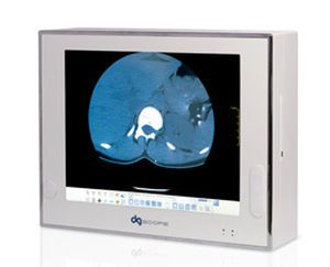 Digital X-ray film viewer / 1-section DGSCOPE