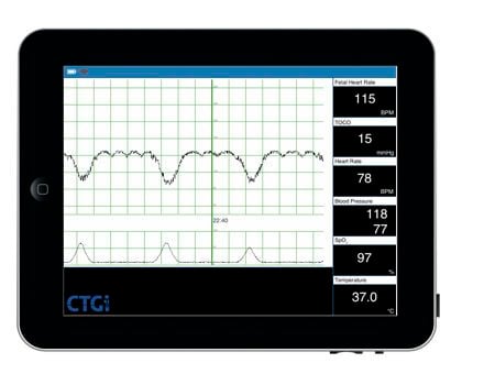 Heart rate simulator / fetal CTGi iSimulate