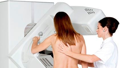 Full-field digital mammography unit / for breast tomosynthesis Giotto Tomo IMS Full-field digital mammography unit / for breast tomosynthesis Giotto Tomo IMS