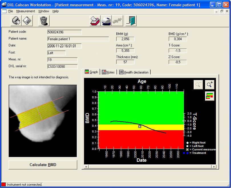 DEXA bone densitometer / fan beam / for heel bones examination / compact DXL Demetech