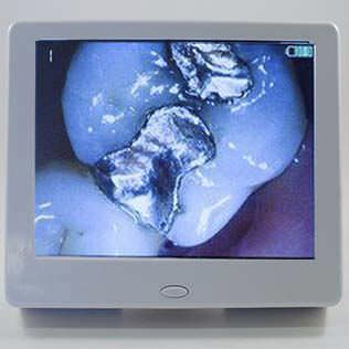 Digital camera / intra-oral / LED / with screen PatientView SD Denterprise