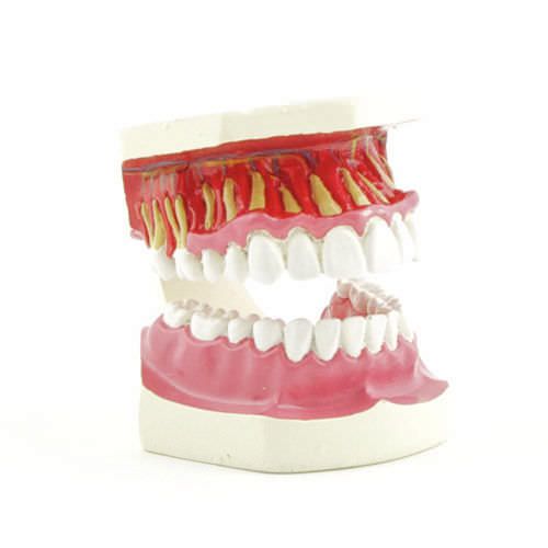 Denture anatomical model H130596 NetMed