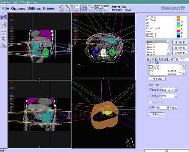Planning software / simulation / for radiation therapy / medical RTPS Neusoft Medical Systems