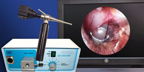 Otoscope veterinary video endoscope / with speculum / rigid Otopet USA