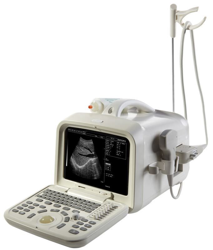 Portable ultrasound system / for multipurpose ultrasound imaging ZQ-6601 Zoncare Electronics