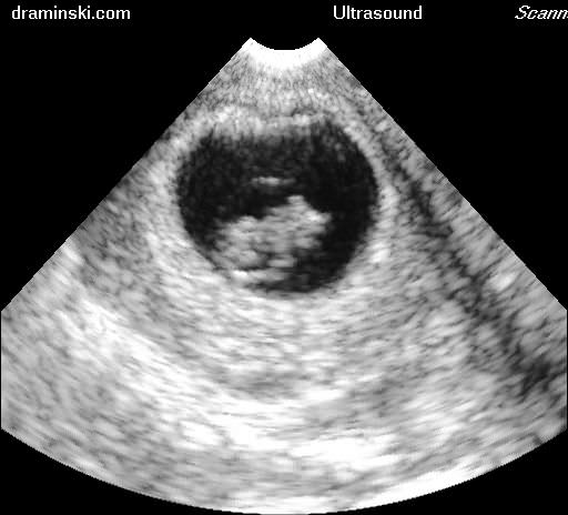 Portable ultrasound system / for abdominal and pelvic ultrasound imaging DUS 101 DRAMINSKI