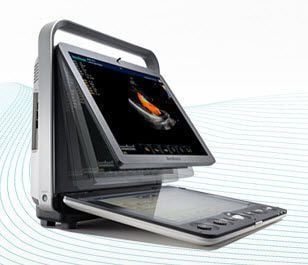 Vascular access doppler / portable / with touchscreen S9 SonoScape Company