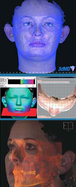 Facial modeling software / surgery / surgery / for plastic surgery 3dMDvultus 3dMD Facial modeling software / surgery / surgery / for plastic surgery 3dMDvultus 3dMD