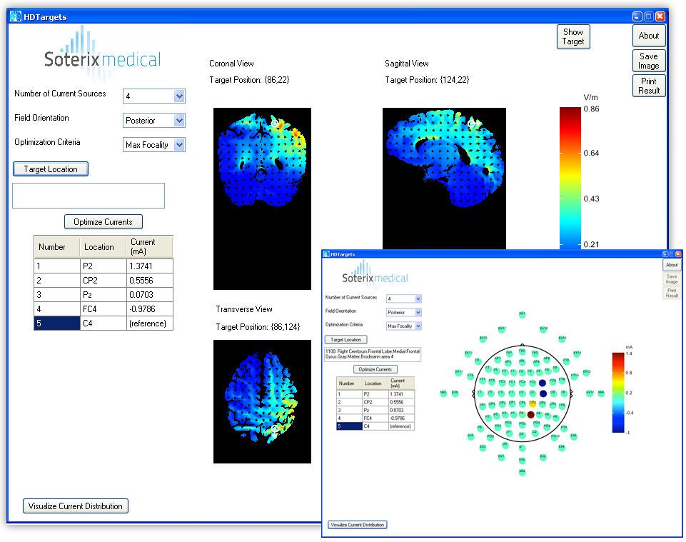 Neurophysiological stimulation software / medical HD-Targets™ Soterix Medical