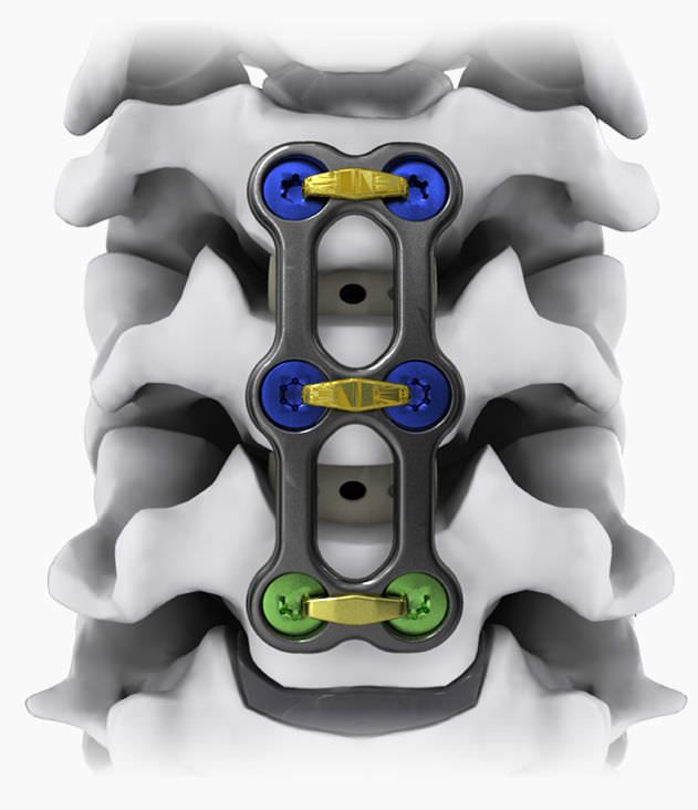 Cervical arthrodesis plate / anterior / 2 levels NEO® Life Spine