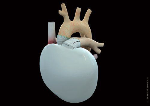 Artificial heart CARMAT Carmat