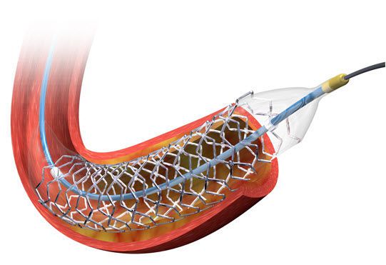 Coronary stent / drug eluting BioMatrix NeoFlex™ Biosensors BV