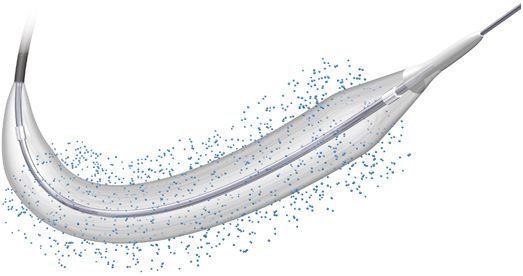 PTCA catheter / balloon BioStream™ Biosensors BV