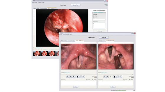 Viewing software / medical / for endoscopy DiVAS XION