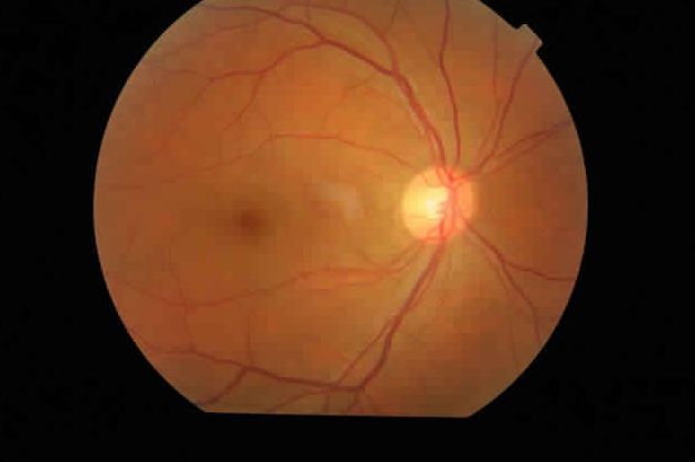 Non-mydriatic retinal camera (ophthalmic examination) / eye fluorescein angiography TRC-NW8F Topcon Europe Medical